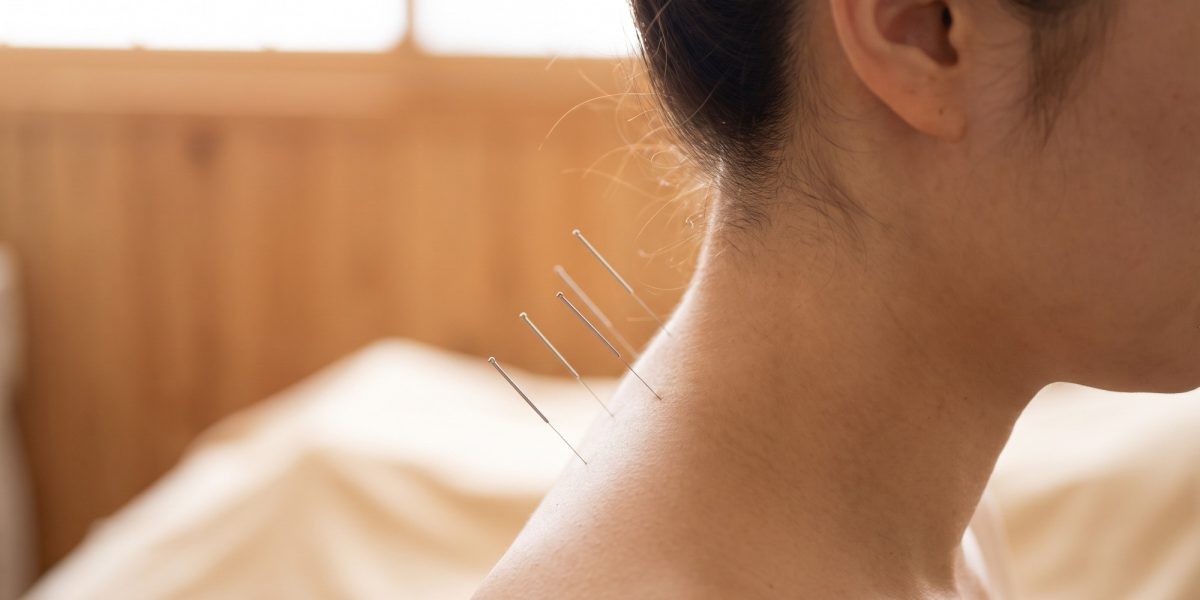 treatment needles inserted into a woman neck in a clinic wellness